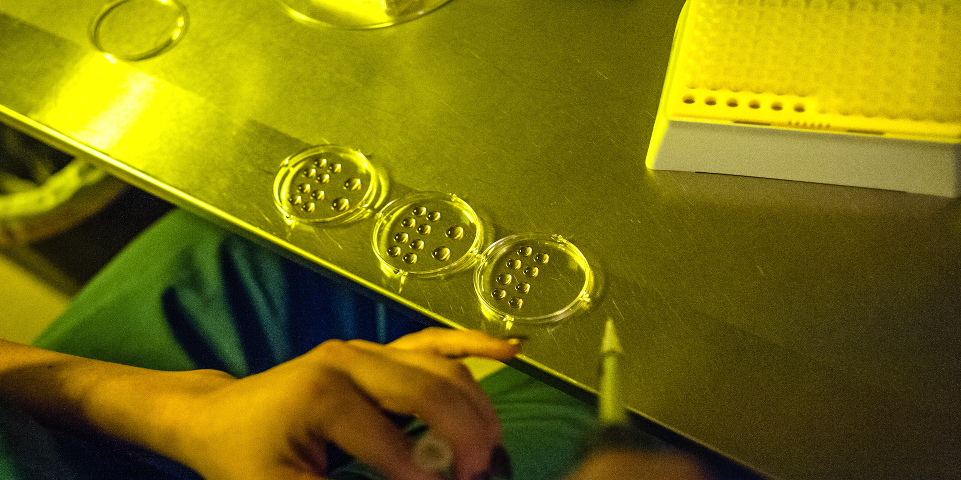 ROCKVILLE, MD -- NOVEMBER 11: Embryologist, Olga Pilshchikova (cq) prepares some eggs for thawing. Shady Grove Fertility, long known for IVF, is now offering egg freezing services for women with health issues or who would otherwise want to postpone childbirth to a later date.. (photo by Andre Chung for The Washington Post via Getty Images)